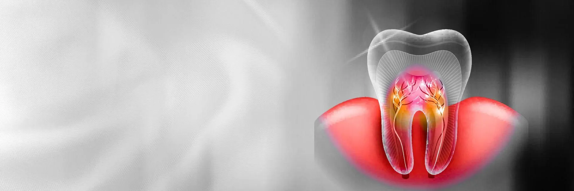 Best Root Canal Treatment in Gurgaon Sector 80 Best Root Canal Treatment in Gurgaon Sector 80