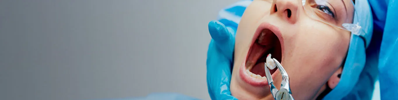 Best Wisdom Tooth Extraction In Gurgaon Sector 80 Best Wisdom Tooth Extraction In Gurgaon Sector 80