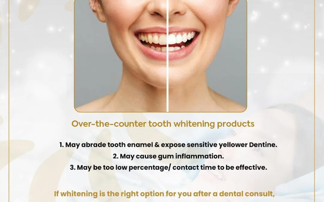 Are teeth whitening toothpastes/ strips/ pens/ powders & other OTC products effective & safe ?
